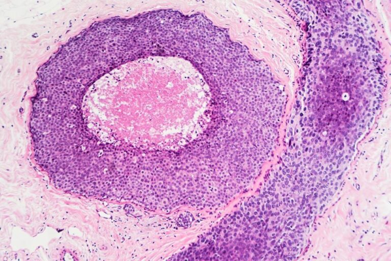What You Have to Know About Most cancers?