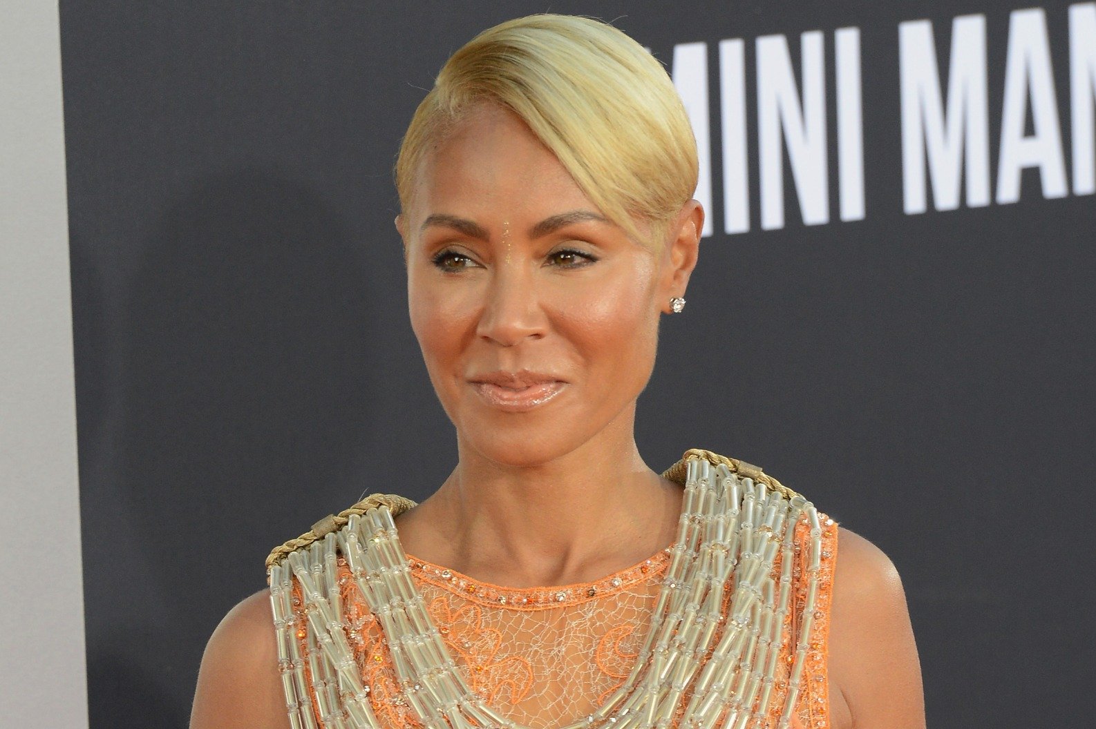 Celebrities Who Are Experiencing Hair Loss